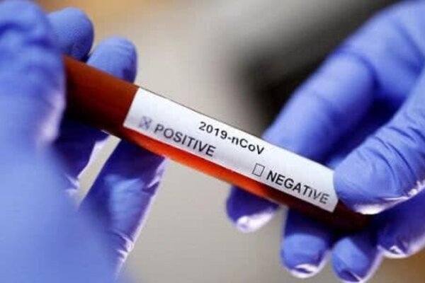 20-летний украинец заразился коронавирусом