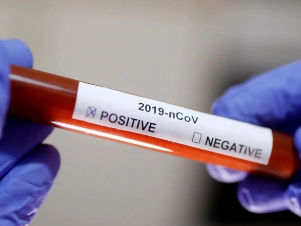 В Украине подтверждены два новых случая заболевания коронавирусом