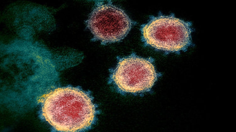 Ученые считают, что коронавирус нового типа на самом деле очень старый
