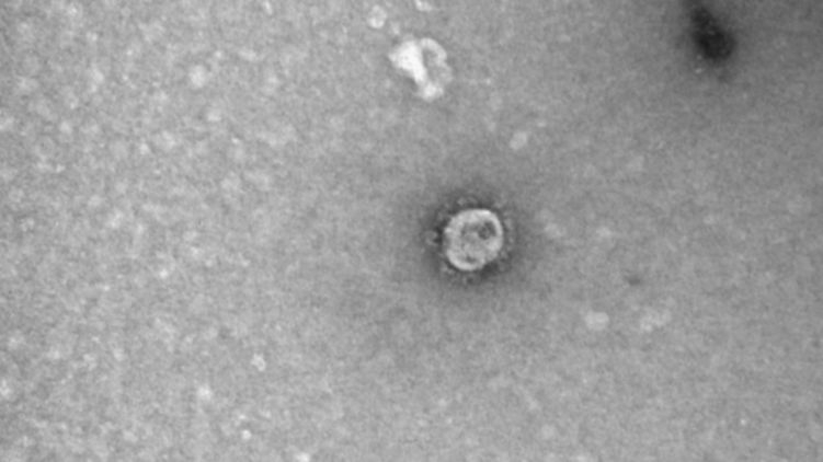 Ученые решили, когда можно выписывать из больниц переболевших коронавирусной инфекцией
