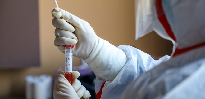 В Николаеве у пациентки один тест подтвердил коронавирус, второй опроверг — ждут результат ПЦР