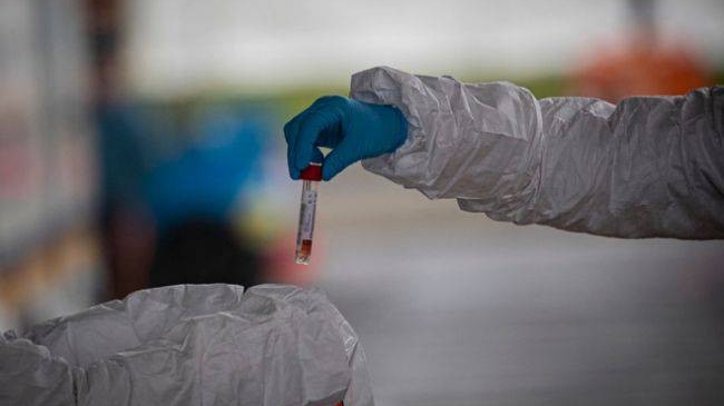 Вакцина от коронавируса может быть готова в сентябре, - вакцинолог Оксфорда