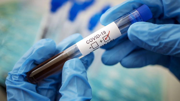 В Украине в протокол лечения коронавируса внесли препарат, предотвращающий свертывание крови
