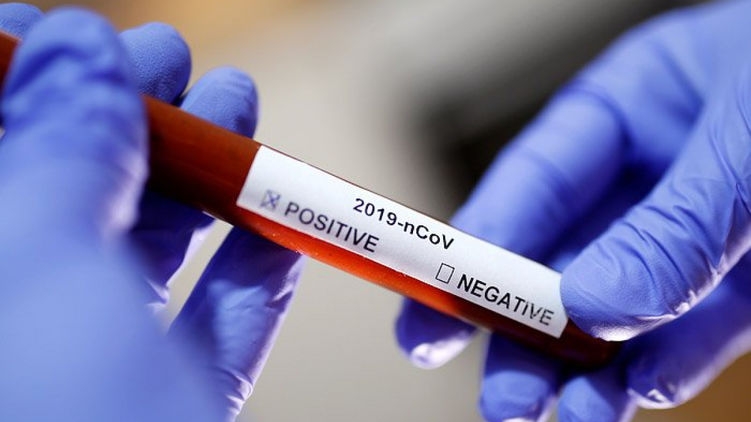 Первые случаи коронавируса фиксировали еще в ноябре в разных частях мира - ВОЗ