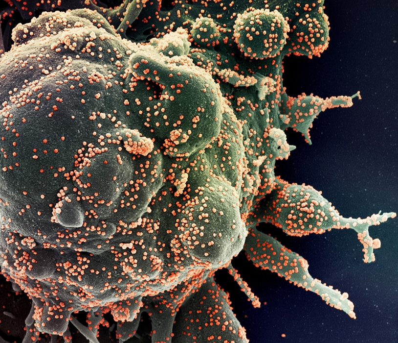 Ученые назвали условие, при котором коронавирус уничтожается за 25 секунд