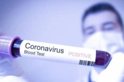 В мире уже 22 миллиона случаев заболевания коронавирусом