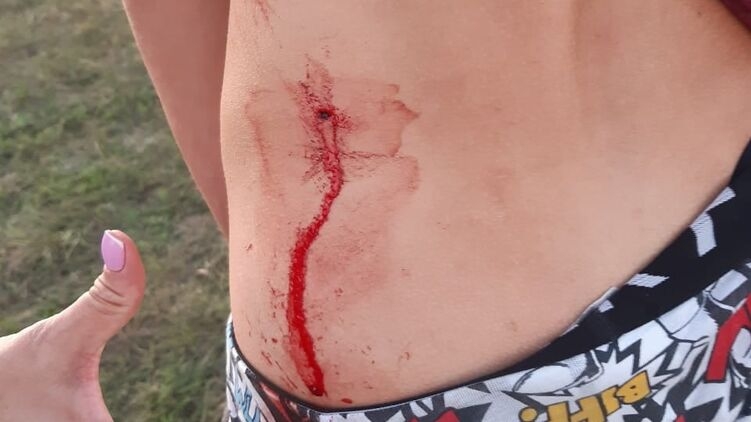 Бывший депутат ударил подростка отверткой за езду на мотоцикле