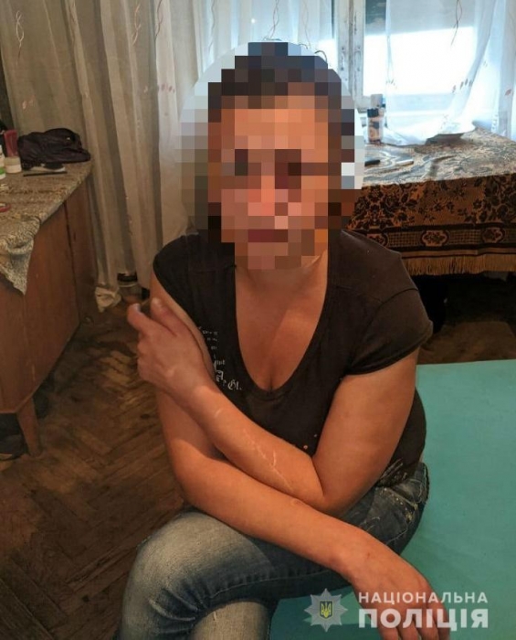 В Киеве женщина ударила ножом в грудь гражданского супруга 