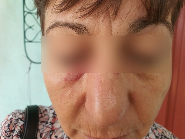 В Сумах пьяная пассажирка избила кондуктора после просьбы надеть маску