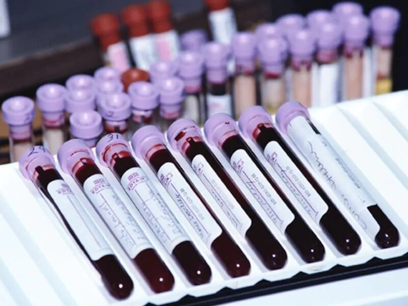 Определена группа крови, обладатели которой наименее уязвимы перед коронавирусом