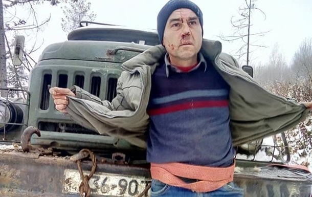 Во Львовской области лесорубы избили и привязали к авто активиста