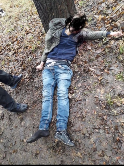 В Днепропетровской области жестоко убили парня: взорвали петарду во рту. ФОТО 18+
