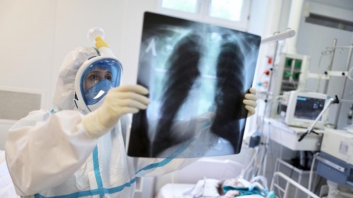 Украина вошла в пятерку европейских стран по числу заразившихся коронавирусом за сутки