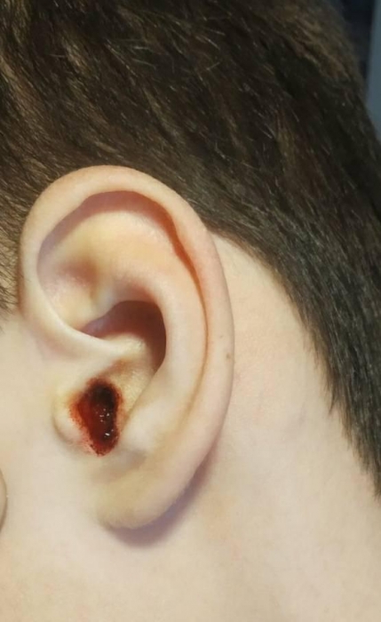 В Николаевской области врач на медосмотре расковырял ребенку ухо до кровавой жижи
