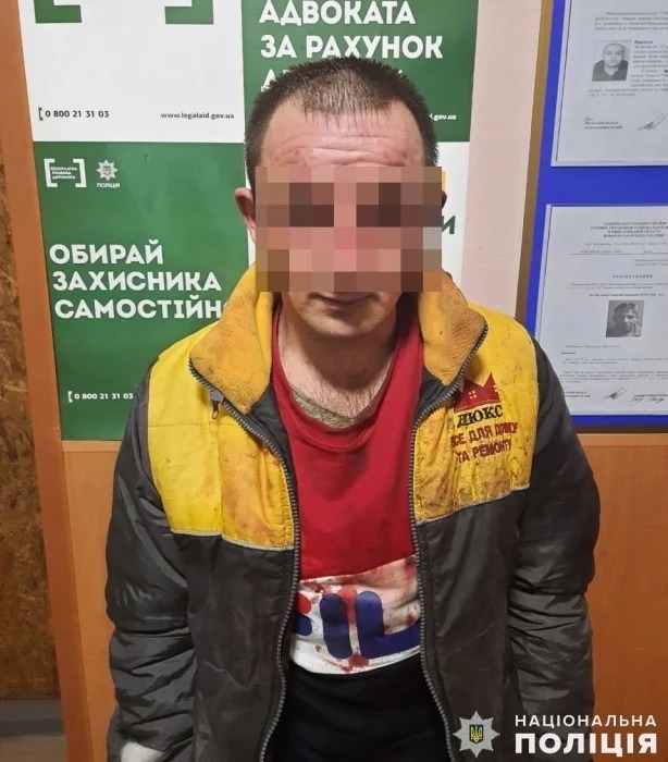 Житель Новой Одессы облил свою семью кислотой – расследование завершено