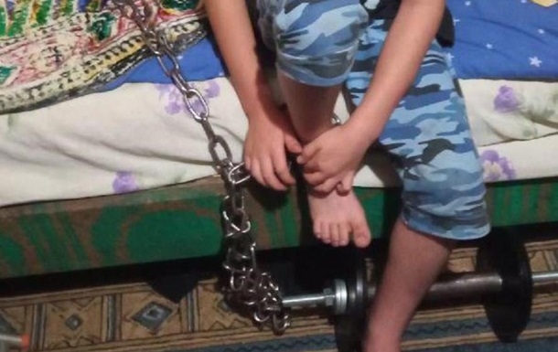 В Кривом Роге 7-летнего мальчика держали на цепи