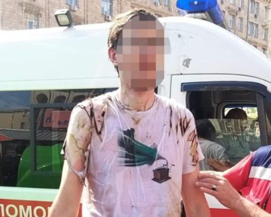 В МВД рассказали подробности об инциденте с самоподжогом во время парада в Киеве