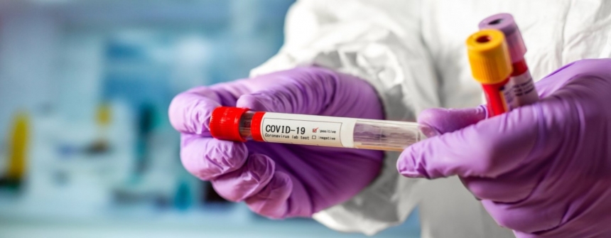 В МОЗ объяснили украинцам, когда следует делать тест на коронавирус