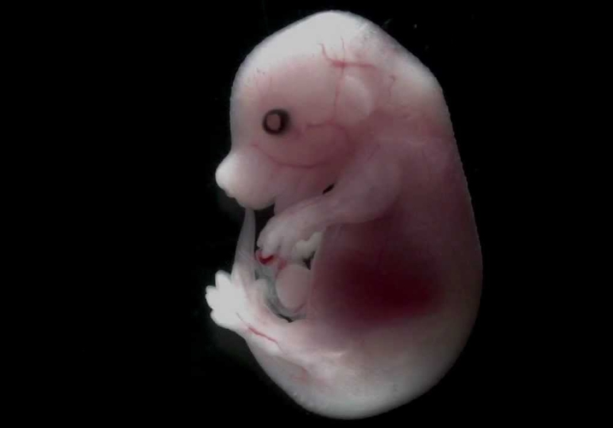 В Китае создали робота-няню, позволяющего вынашивать эмбрионы в искусственной матке