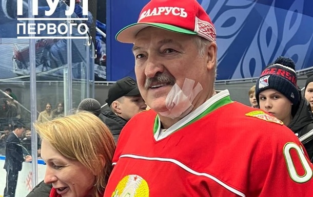 Лукашенко получил клюшкой по лицу (видео)