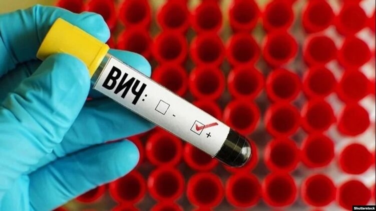 За время войны в Украине зарегистрировано 779 новых случаев ВИЧ