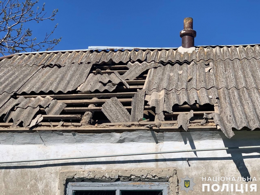 За прошедшие сутки ранения получили 15 жителей Николаевской области