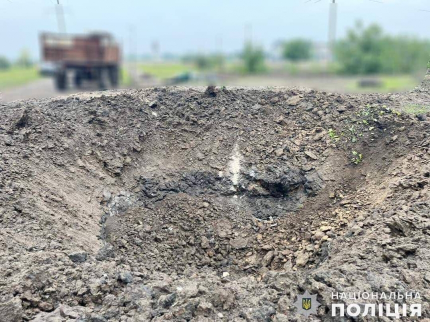 У лікарнях Миколаївської області – 490 потерпілих від ворожих обстрілів