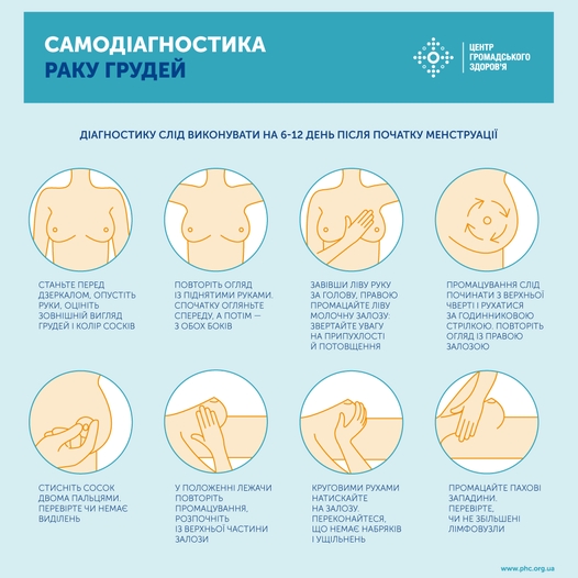 Каждая 12-я украинка болеет раком молочной железы - медики рассказали, как провести диагностику дома