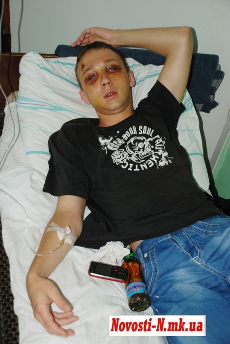 Уголовное дело, возбужденное по факту избиения николаевского студента, передано в прокуратуру