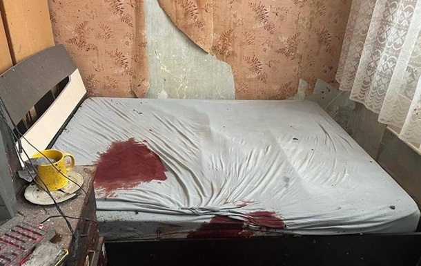 В квартире в Киевской области взорвалась граната- 21-летнему парню «разнесло» руку