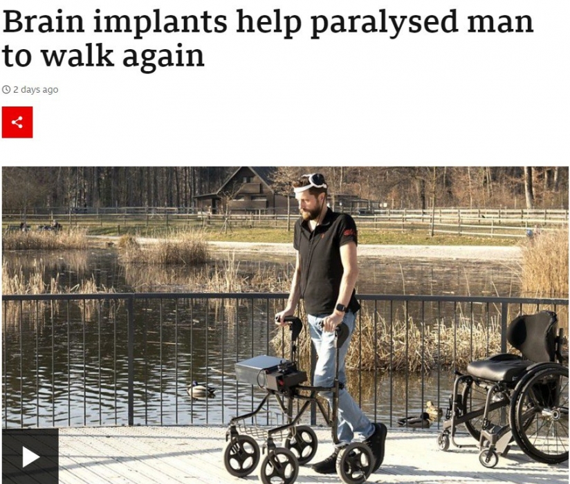 Чоловік, який 12 років був паралізований, почав ходити завдяки мозковим імплантам