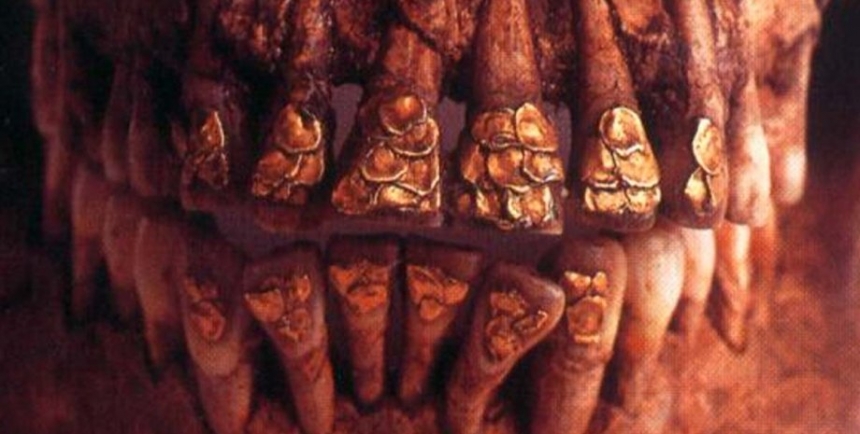 Древняя стоматология была дорогой: о чем рассказал старинный череп с золотыми зубами