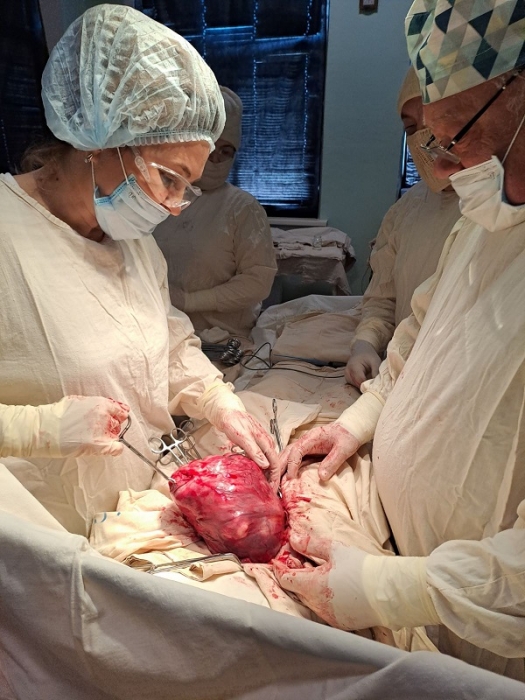 У Миколаєві лікарі провели унікальну операцію: видалили пухлину вагою майже 2 кг (фото)