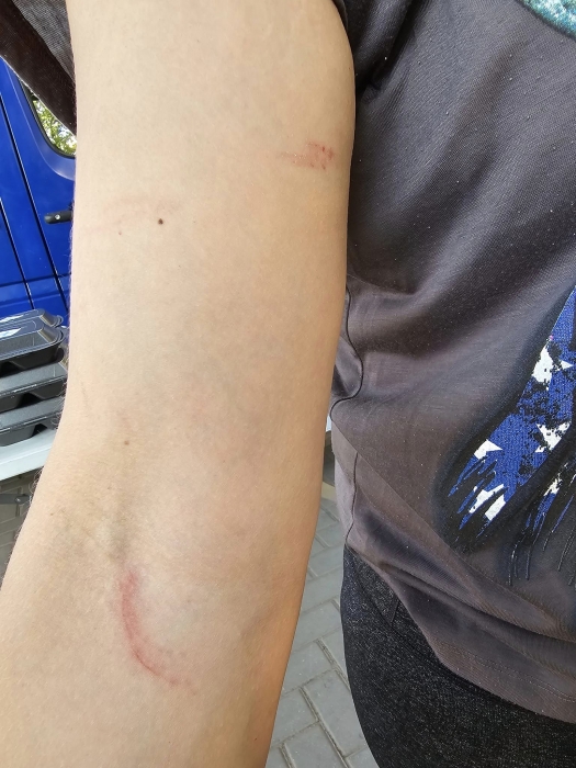 В Николаеве во время раздачи гуманитарной помощи напали на волонтеров
