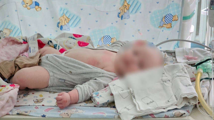 Из-за обстрела врага жительница Николаевщины осталась без ноги, у ее двухмесячной малышки травмы
