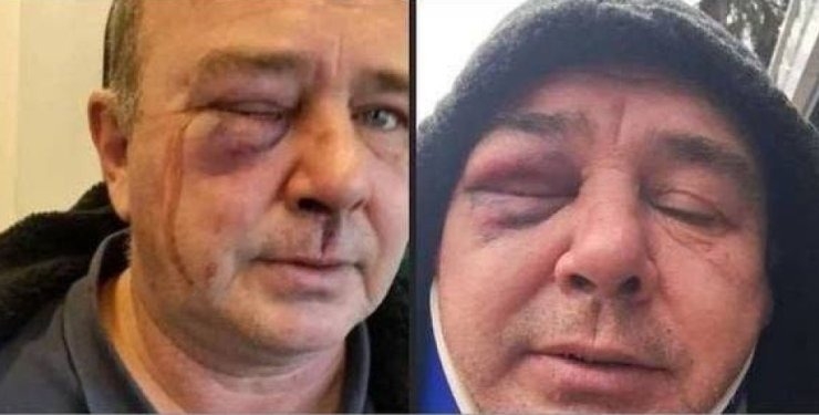 В Киевской области работники ТЦК жестоко избили мужчину на глазах у полиции