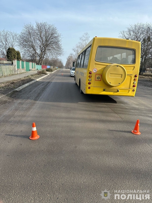 На Вінниччині 10-річний хлопчик потрапив під колеса шкільного автобуса