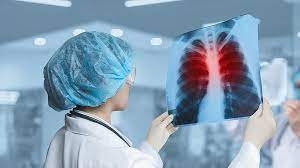 «Болезнь бедных»: в ОВА заявили о росте количества заболевших туберкулезом в Николаеве и области
