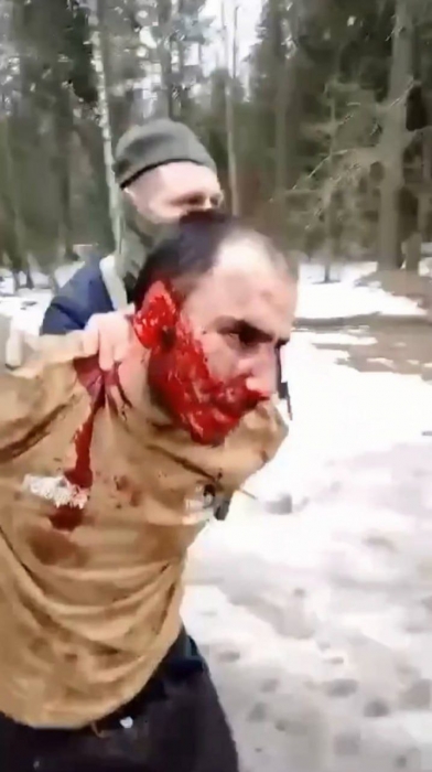 Задержанному после теракта в Москве отрезали ухо и засунули в рот: видео 18+