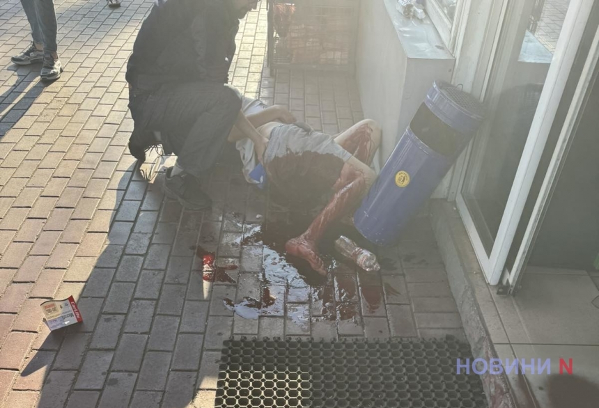 Чоловік із ножовим пораненням буквально стік кров'ю на автозаправці в центрі Миколаєва