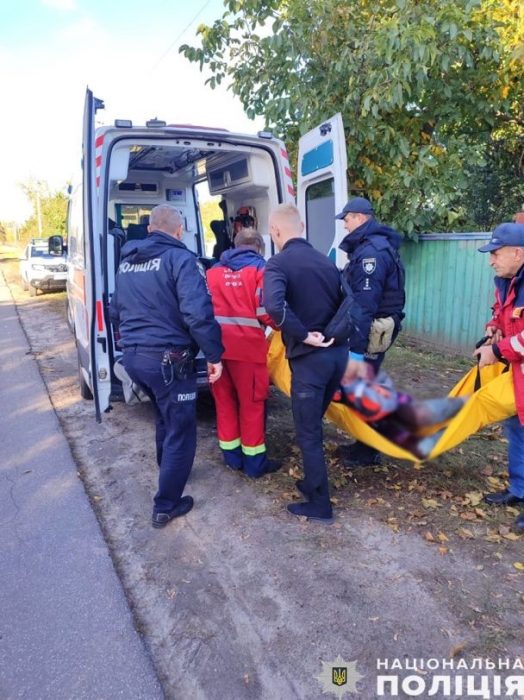 На Чернігівщині у приватному будинку вибухнула граната