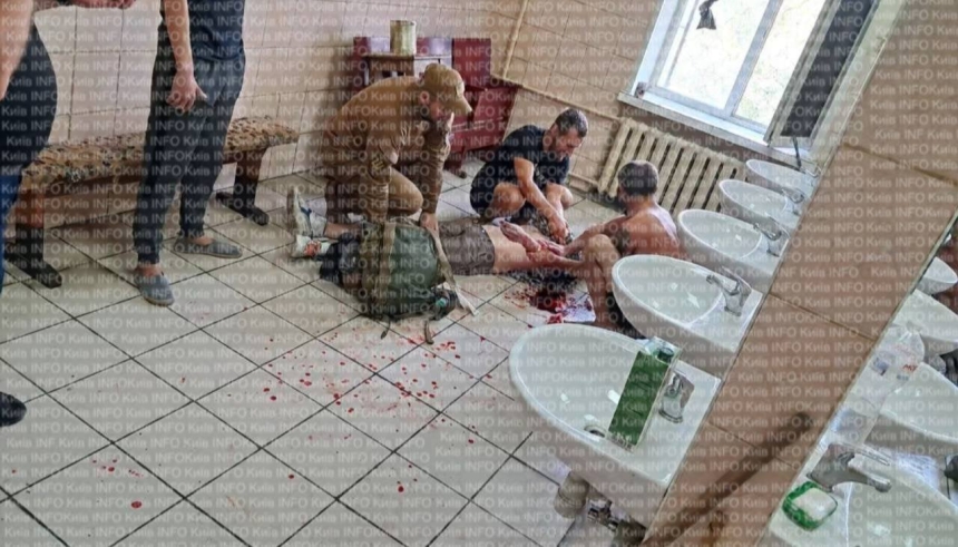 Мобилизованный порезал себе вены в распределительном центре (фото, видео 18+)