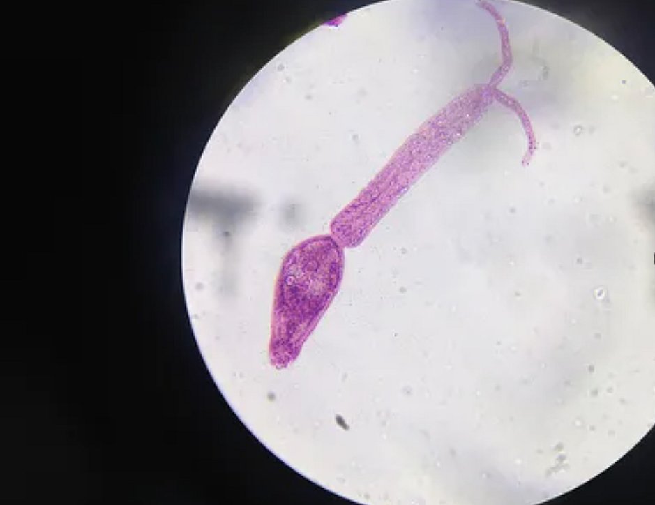 Опасное паразитарное заболевание выявлено у пенсионерки на Черниговщине: гельминты находятся на шерсти собак