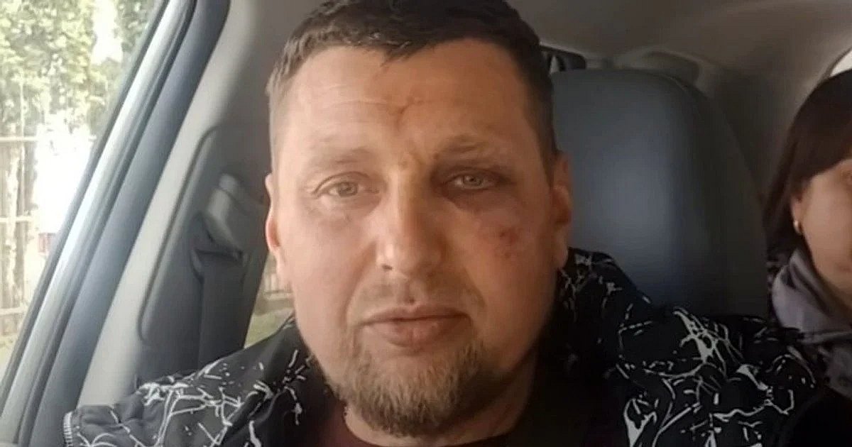 Ветеран с инвалидностью заявляет об избиении сотрудниками ТЦК: военкомы заявили, что напали на них