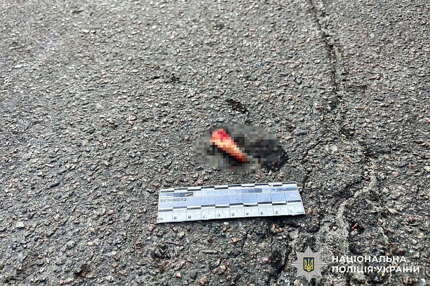 В Ровенской области врачи более восьми месяцев боролись за жизнь женщины после ДТП