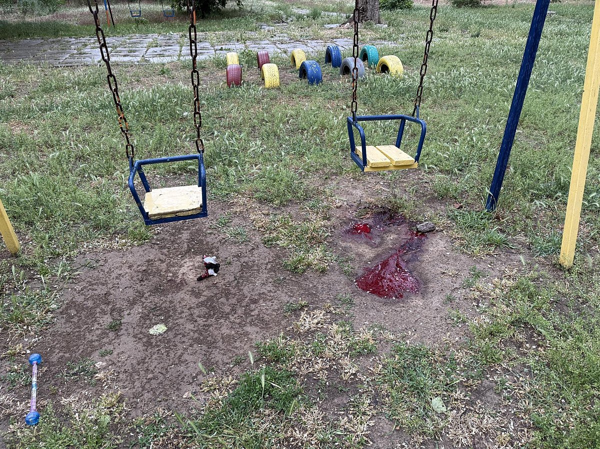 Трехлетнюю девочку, попавшую под обстрел на детской площадке в Херсоне, привезли в Николаев
