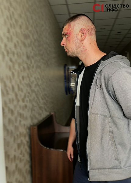Подозреваемый в нападении на полицейских во время конфликта с ТЦК во Львове оказался военнослужащим
