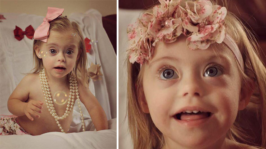 Двухлетняя девочка с синдромом Дауна стала моделью. ФОТО