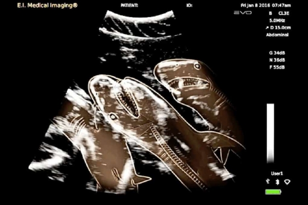 15 удивительных рентгеновских снимков беременных животных