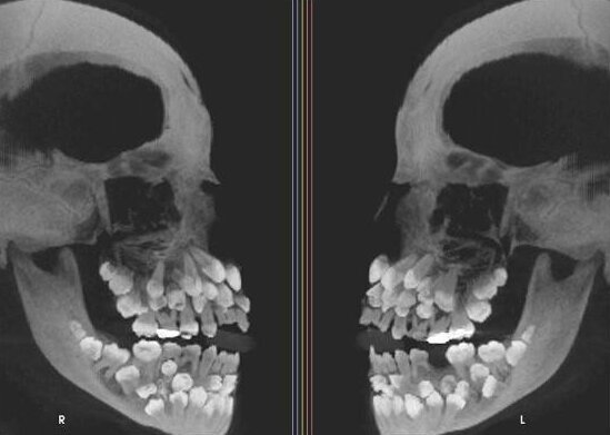  18 рентгеновских снимков, которые врачи запомнят надолго (19 фото) 